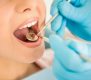 رابطه جرمگیری دندان و کاهش خطر سکته قلبی
