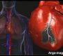 اولین نشانه ها و علایم سکته قلبی