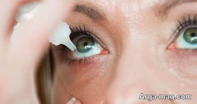 روش درمانی برق زدگی چشم