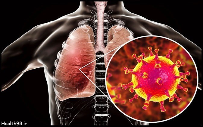 دیابت و افزایش خطر ابتلا به عفونت‌های تنفسی ویروسی