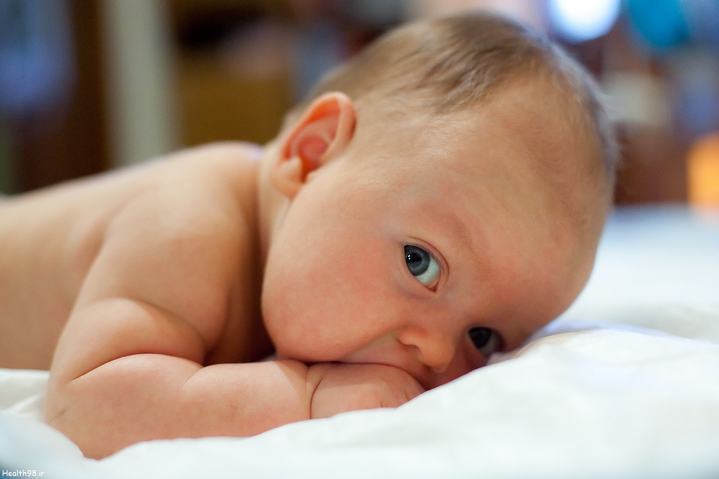 معرفی بهترین راهکارها جهت درمان زردی نوزاد