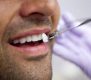 ۵ مورد از درمان های گرانقیمت دندانپزشکی در جهان