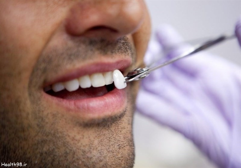 درمان های گرانقیمت دندانپزشکی در جهان