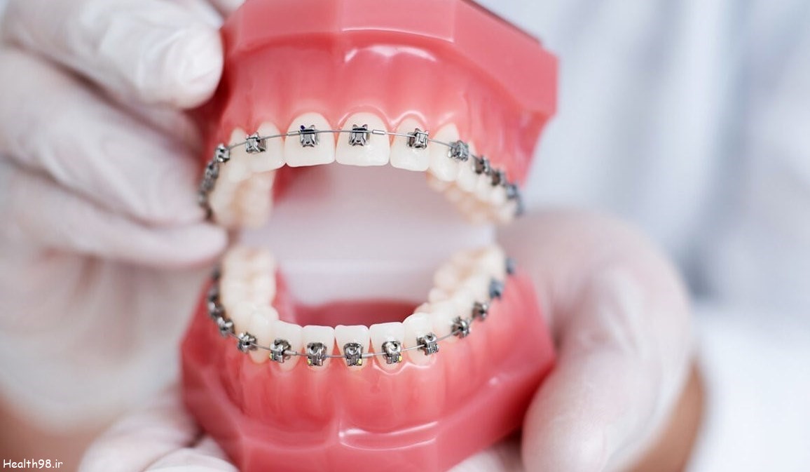 ارتودنسی دندان در مشهد