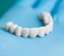 محاسبه ارزش دندان به کمک مشاوره حقوقی