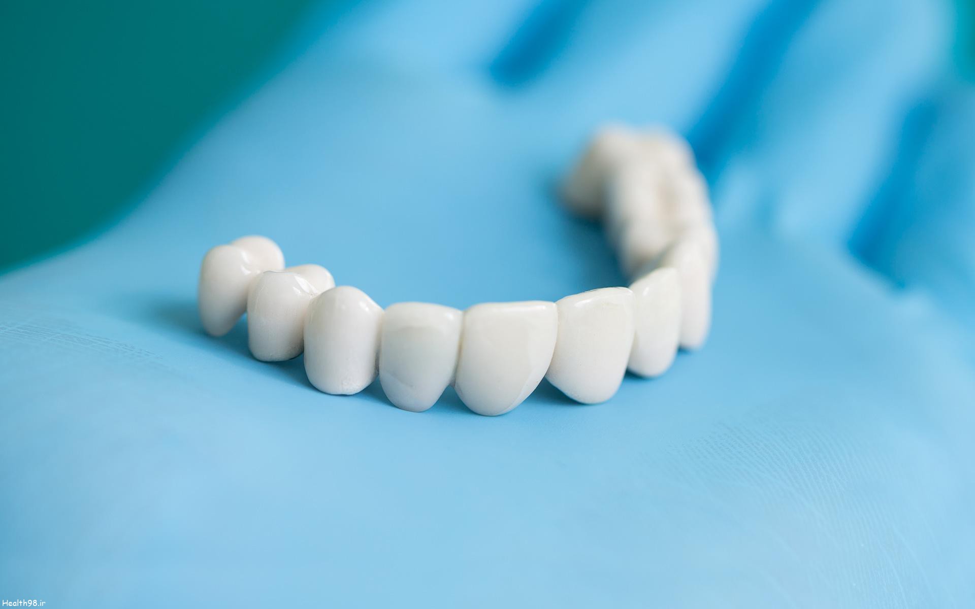 محاسبه ارزش دندان به کمک مشاوره حقوقی